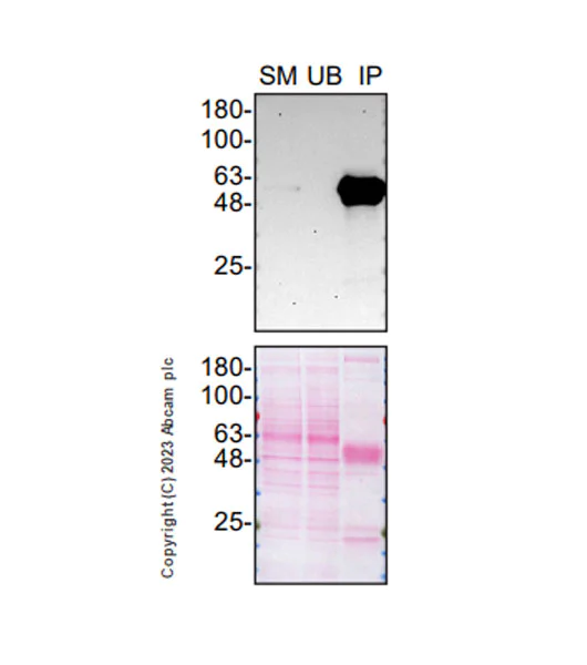 Immunoprecipitation - Anti-SMOC1 antibody [EPR26922-29] (AB313569)