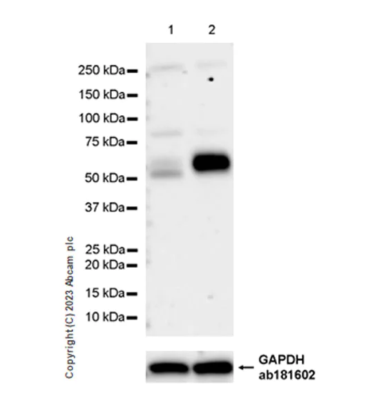 Western blot - Anti-SMOC1 antibody [EPR26922-29] (AB313569)