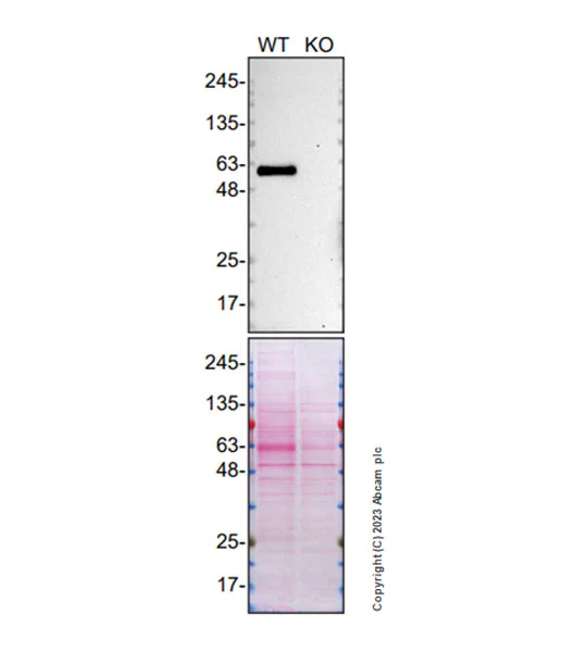 Western blot - Anti-SMOC1 antibody [EPR26922-29] - BSA and Azide free (AB313570)