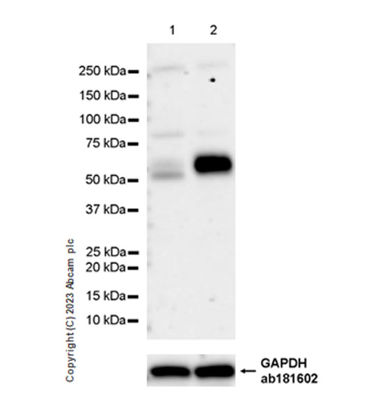 Western blot - Anti-SMOC1 antibody [EPR26922-29] - BSA and Azide free (AB313570), expandable thumbnail