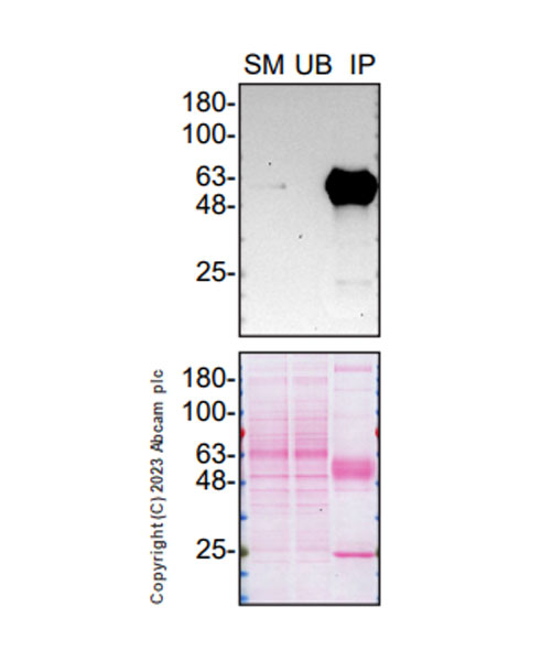Immunoprecipitation - Anti-SMOC1 antibody [EPR26922-31] (AB313571), expandable thumbnail