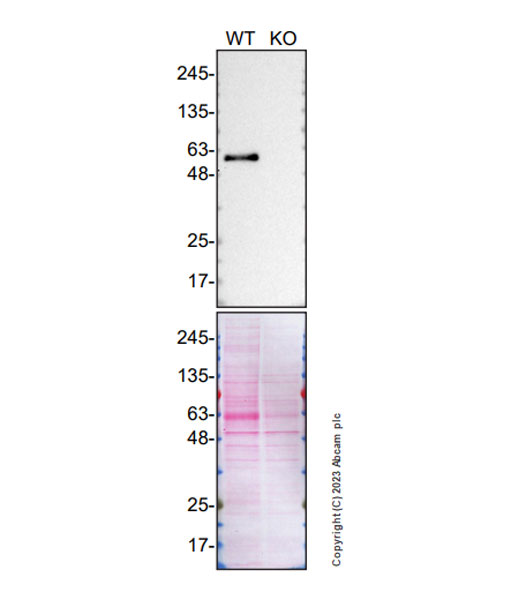 Western blot - Anti-SMOC1 antibody [EPR26922-31] (AB313571), expandable thumbnail