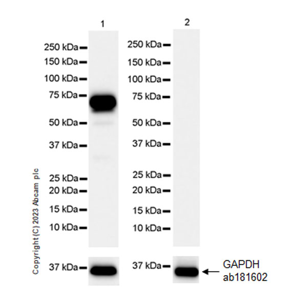 Western blot - Anti-SMOC1 antibody [EPR26922-31] (AB313571), expandable thumbnail