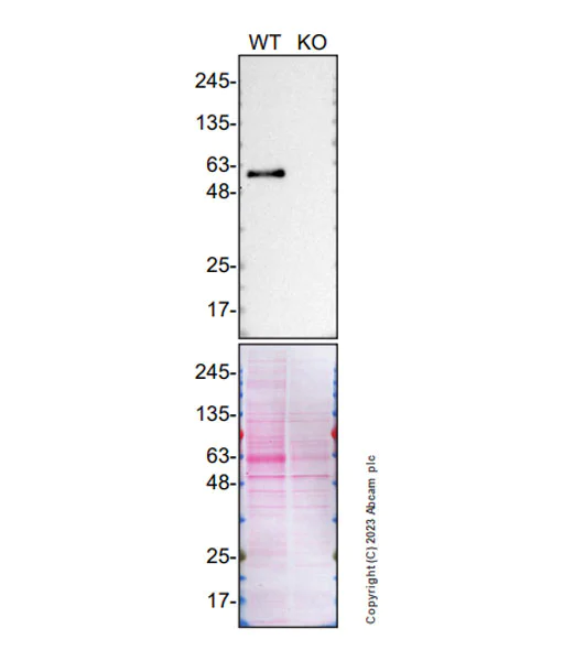 Western blot - Anti-SMOC1 antibody [EPR26922-31] - BSA and Azide free (AB313572)