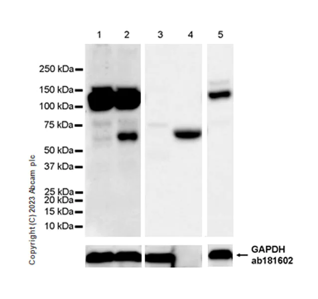 Western blot - Anti-SMOC1 antibody [EPR26922-31] - BSA and Azide free (AB313572)