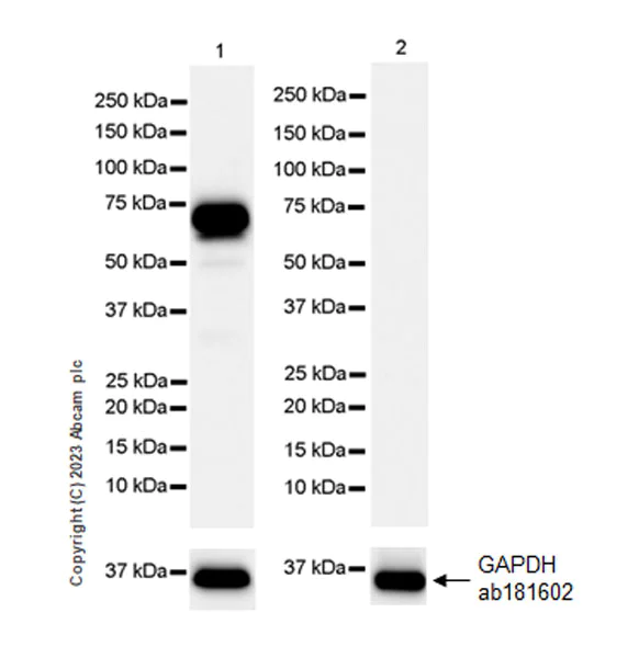 Western blot - Anti-SMOC1 antibody [EPR26922-31] - BSA and Azide free (AB313572)