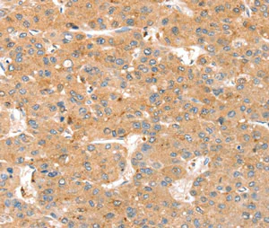 Immunohistochemistry (Formalin/PFA-fixed paraffin-embedded sections) - Anti-SMOC2 antibody - C-terminal (AB198715)