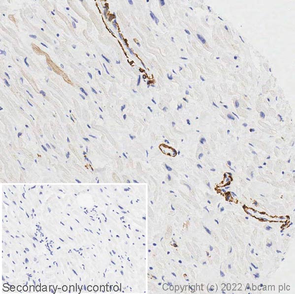 Immunohistochemistry (Formalin/PFA-fixed paraffin-embedded sections) - Anti-smooth muscle Myosin heavy chain 11 antibody (AB125884)