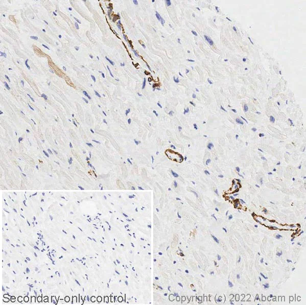 Immunohistochemistry (Formalin/PFA-fixed paraffin-embedded sections) - Anti-smooth muscle Myosin heavy chain 11 antibody (AB125884)