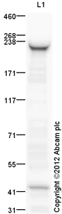 Western blot - Anti-smooth muscle Myosin heavy chain 11 antibody (AB125884)