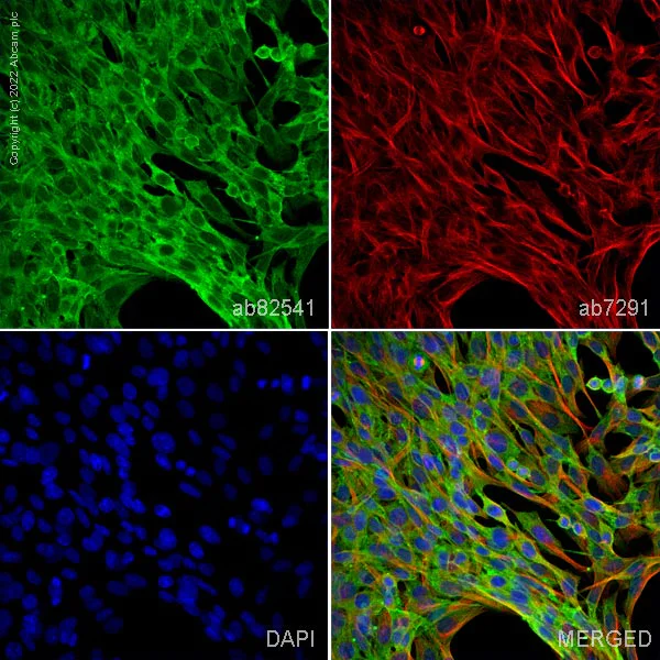 Immunocytochemistry - Anti-smooth muscle Myosin heavy chain 11 antibody (AB82541)