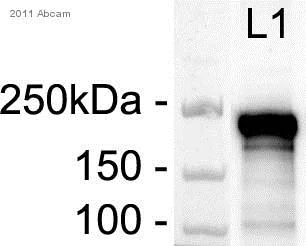 Western blot - Anti-smooth muscle Myosin heavy chain 11 antibody (AB82541)