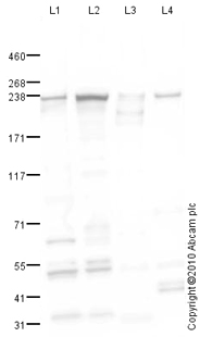 Western blot - Anti-smooth muscle Myosin heavy chain 11 antibody (AB82541)