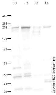 Western blot - Anti-smooth muscle Myosin heavy chain 11 antibody (AB82541)