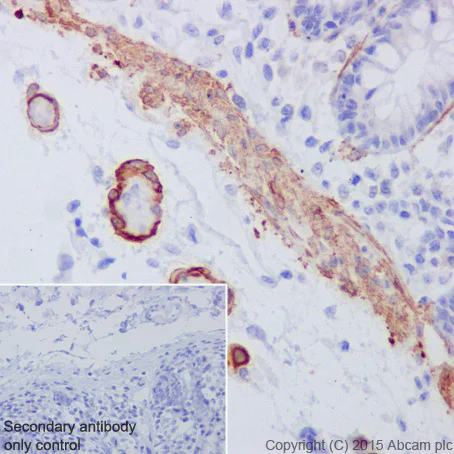 Immunohistochemistry (Formalin/PFA-fixed paraffin-embedded sections) - Anti-smooth muscle Myosin heavy chain 11 antibody [EPR5335] (AB124679)