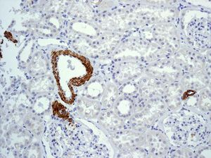 Anti-smooth muscle Myosin heavy chain 11 antibody [EPR5335