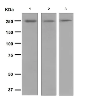 Western blot - Anti-smooth muscle Myosin heavy chain 11 antibody [EPR5335] (AB124679)
