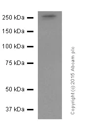 Western blot - Anti-smooth muscle Myosin heavy chain 11 antibody [EPR5335] (AB124679)