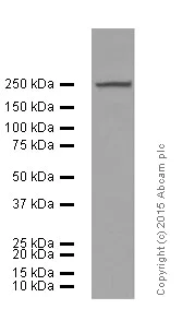 Western blot - Anti-smooth muscle Myosin heavy chain 11 antibody [EPR5335] (AB124679)