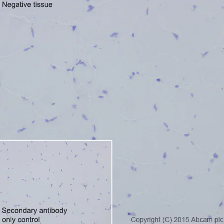 Immunohistochemistry (Formalin/PFA-fixed paraffin-embedded sections) - Anti-smooth muscle Myosin heavy chain 11 antibody [EPR5335] - BSA and Azide free (AB247958)