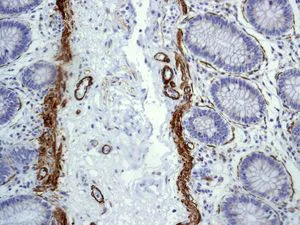 Immunohistochemistry (Formalin/PFA-fixed paraffin-embedded sections) - Anti-smooth muscle Myosin heavy chain 11 antibody [EPR5335] - BSA and Azide free (AB247958)