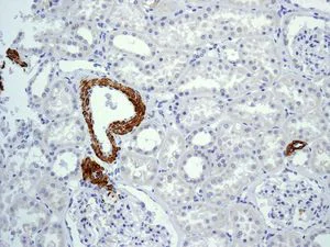 Immunohistochemistry (Formalin/PFA-fixed paraffin-embedded sections) - Anti-smooth muscle Myosin heavy chain 11 antibody [EPR5335] - BSA and Azide free (AB247958)