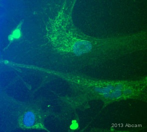 Immunocytochemistry/ Immunofluorescence - Anti-smooth muscle Myosin heavy chain 11 antibody [EPR5336(B)] (ab133567), expandable thumbnail