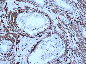 Immunohistochemistry (Formalin/PFA-fixed paraffin-embedded sections) - Anti-smooth muscle Myosin heavy chain 11 antibody [EPR5336(B)] (ab133567), expandable thumbnail