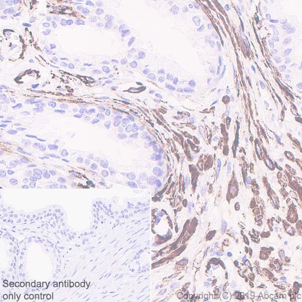 Immunohistochemistry (Formalin/PFA-fixed paraffin-embedded sections) - Anti-smooth muscle Myosin heavy chain 11 antibody [EPR5336(B)] (AB133567), expandable thumbnail