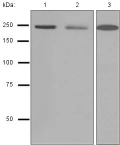 Western blot - Anti-smooth muscle Myosin heavy chain 11 antibody [EPR5336(B)] (AB133567)