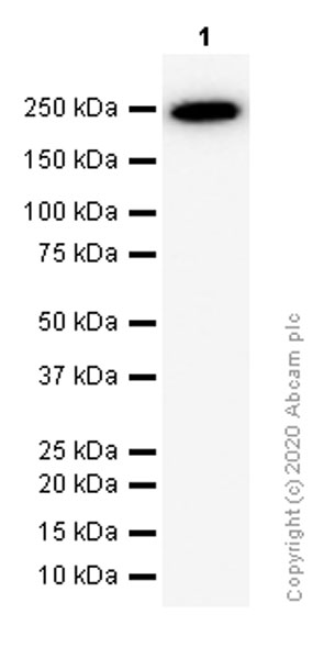 Western blot - Anti-smooth muscle Myosin heavy chain 11 antibody [EPR5336(B)] (AB133567), expandable thumbnail