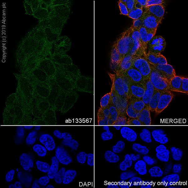 Immunocytochemistry/ Immunofluorescence - Anti-smooth muscle Myosin heavy chain 11 antibody [EPR5336(B)] - BSA and Azide free (AB240069), expandable thumbnail