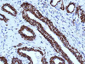 Immunohistochemistry (Formalin/PFA-fixed paraffin-embedded sections) - Anti-smooth muscle Myosin heavy chain 11 antibody [EPR5336(B)] - BSA and Azide free (AB240069)
