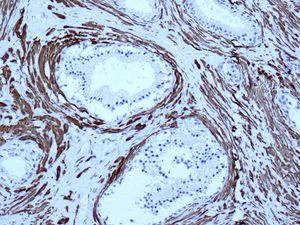 Immunohistochemistry (Formalin/PFA-fixed paraffin-embedded sections) - Anti-smooth muscle Myosin heavy chain 11 antibody [EPR5336(B)] - BSA and Azide free (AB240069)