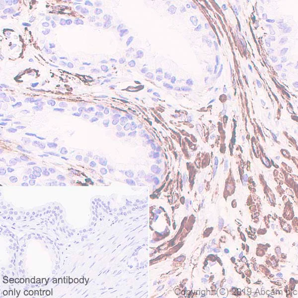 Immunohistochemistry (Formalin/PFA-fixed paraffin-embedded sections) - Anti-smooth muscle Myosin heavy chain 11 antibody [EPR5336(B)] - BSA and Azide free (AB240069)