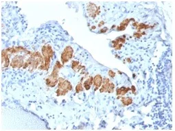 Immunohistochemistry (Formalin/PFA-fixed paraffin-embedded sections) - Anti-smooth muscle Myosin heavy chain 11 antibody [MYH11/2303R] (AB234318)