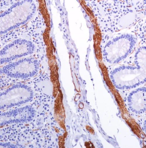 Immunohistochemistry (Formalin/PFA-fixed paraffin-embedded sections) - Anti-smooth muscle Myosin heavy chain 11 antibody [SP314] - BSA and Azide free (AB240983)