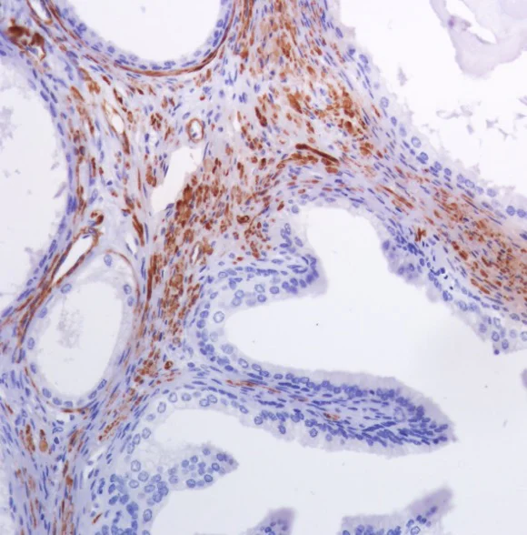 Immunohistochemistry (Formalin/PFA-fixed paraffin-embedded sections) - Anti-smooth muscle Myosin heavy chain 11 antibody [SP314] - BSA and Azide free (AB240983)