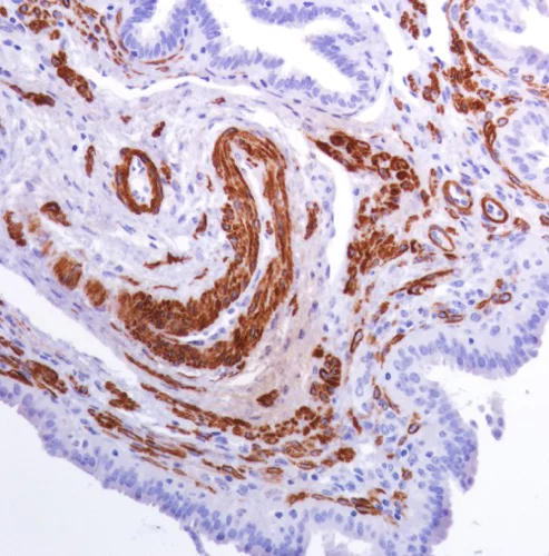 Immunohistochemistry (Formalin/PFA-fixed paraffin-embedded sections) - Anti-smooth muscle Myosin heavy chain 11 antibody [SP314] - BSA and Azide free (AB240983)