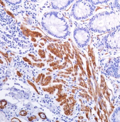 Immunohistochemistry (Formalin/PFA-fixed paraffin-embedded sections) - Anti-smooth muscle Myosin heavy chain 11 antibody [SP314] - BSA and Azide free (AB240983)