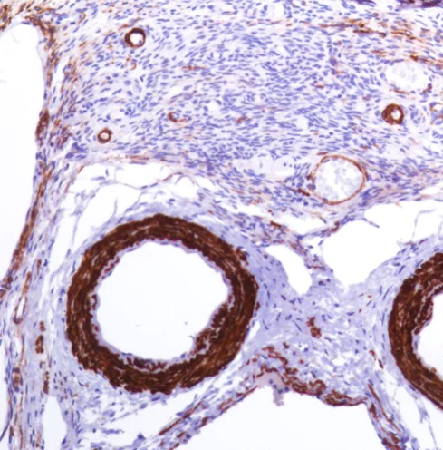 Immunohistochemistry (Formalin/PFA-fixed paraffin-embedded sections) - Anti-smooth muscle Myosin heavy chain 11 antibody [SP314] - BSA and Azide free (AB240983)