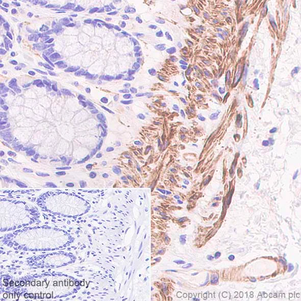 Immunohistochemistry (Formalin/PFA-fixed paraffin-embedded sections) - Anti-smooth muscle Myosin heavy chain 11 antibody [SP314] - BSA and Azide free (AB240983)