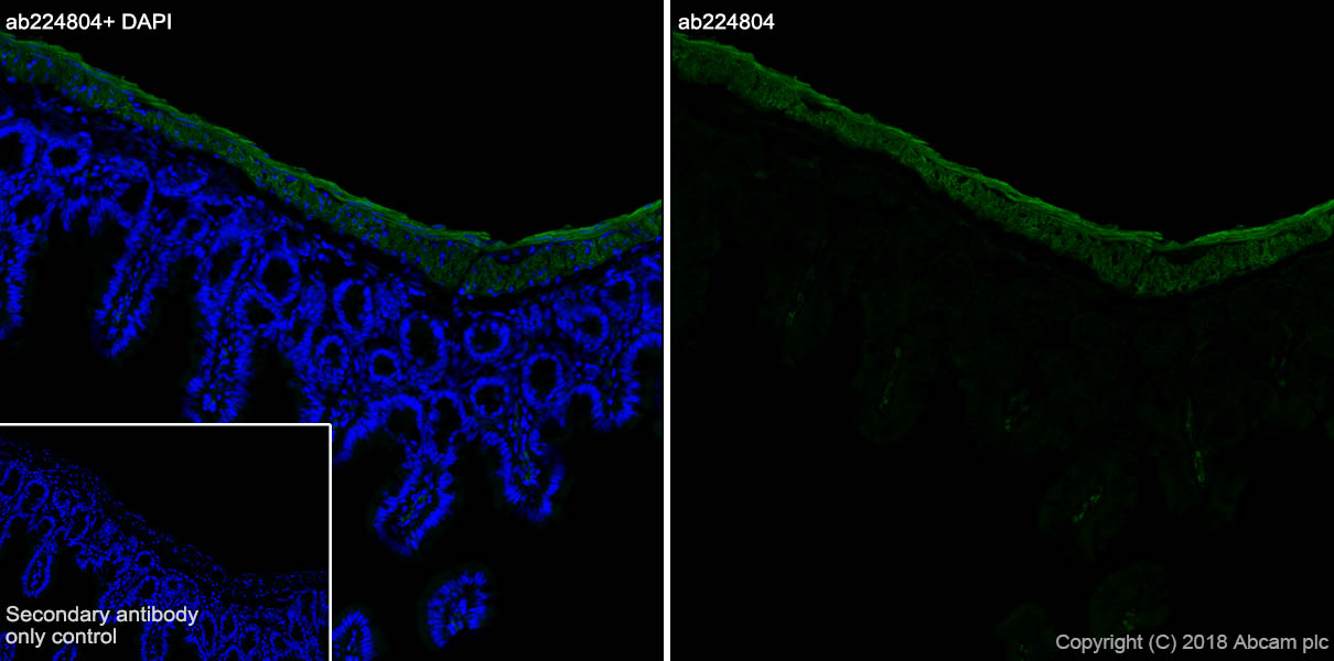 Anti-smooth muscle Myosin heavy chain 11 antibody [SP314