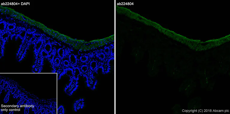 Immunohistochemistry (Frozen sections) - Anti-smooth muscle Myosin heavy chain 11 antibody [SP314] - BSA and Azide free (AB240983)