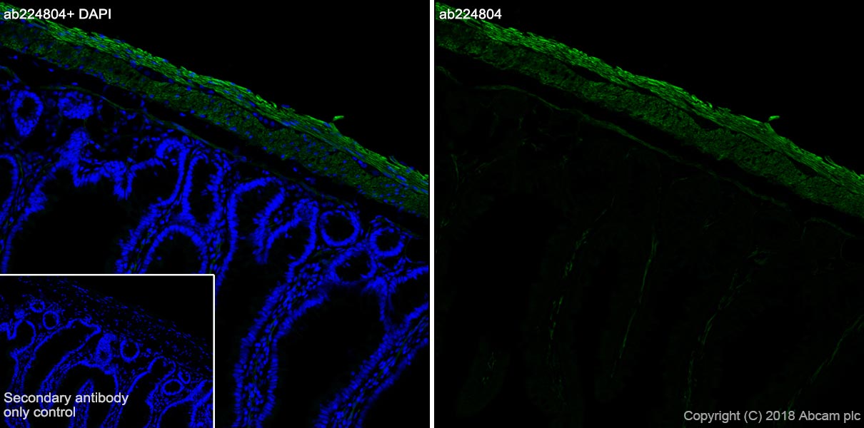 Anti-smooth muscle Myosin heavy chain 11 antibody [SP314