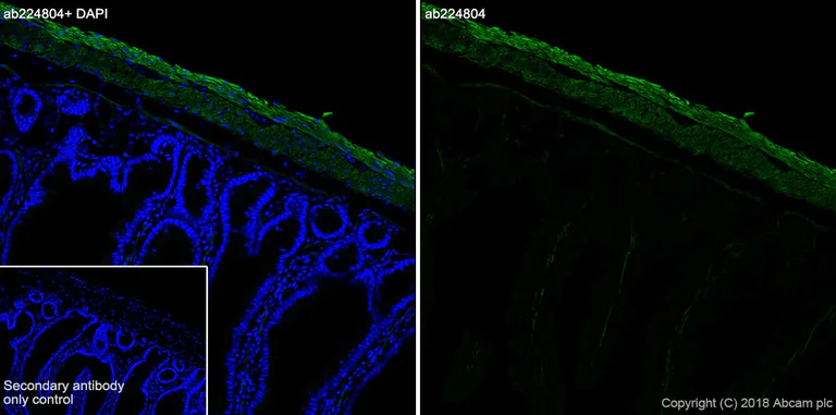 Immunohistochemistry (Frozen sections) - Anti-smooth muscle Myosin heavy chain 11 antibody [SP314] - BSA and Azide free (AB240983)