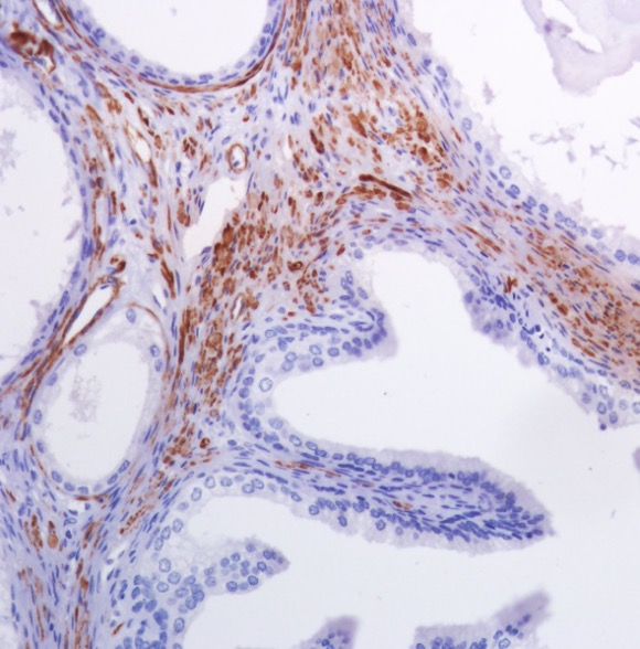 Immunohistochemistry (Formalin/PFA-fixed paraffin-embedded sections) - Anti-smooth muscle Myosin heavy chain 11 antibody [SP314] - N-terminal (ab224804), expandable thumbnail