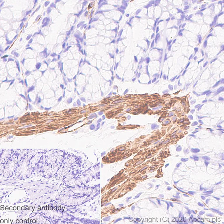 Anti-smooth muscle Myosin heavy chain 11 antibody [SP314