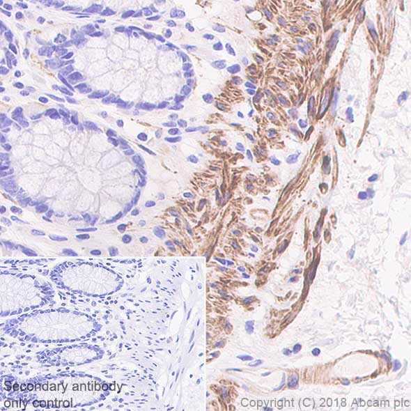 Immunohistochemistry (Formalin/PFA-fixed paraffin-embedded sections) - Anti-smooth muscle Myosin heavy chain 11 antibody [SP314] - N-terminal (AB224804), expandable thumbnail