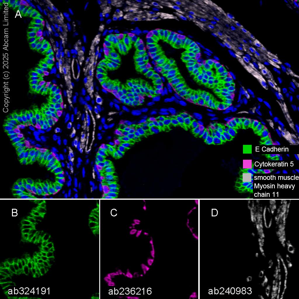 Anti-smooth muscle Myosin heavy chain 11 antibody [SP314